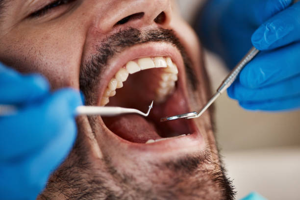 Best Emergency Dental Care for Trauma or Injury in North Rock Springs, WY