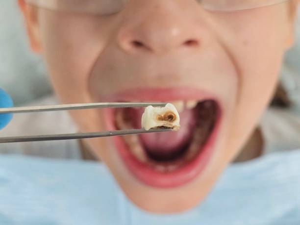 Best Pediatric Emergency Dentist in North Rock Springs, WY