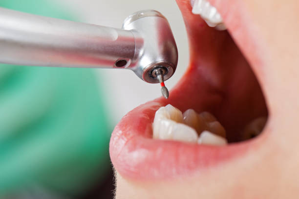 Best Emergency Treatment for Toothache in North Rock Springs, WY